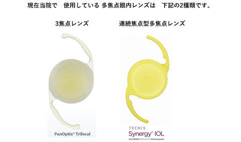 パンオプティクス
シナジー