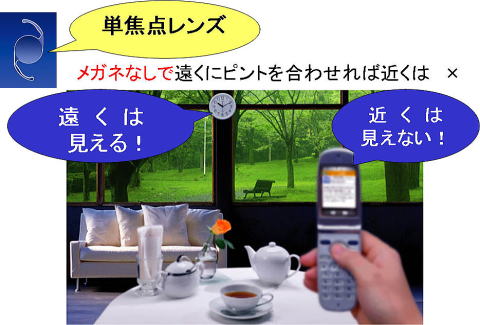 単焦点眼内レンズ